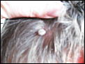 OMG - Look what was attached to my son's head (not for the squeamish)-tick1.jpg