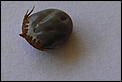 OMG - Look what was attached to my son's head (not for the squeamish)-tick2.jpg
