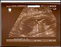 Sept 07 - March 08 applicants check in thread-babyscan0001.jpg
