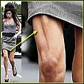 RIP Amy Winehouse-amys-leg.jpg